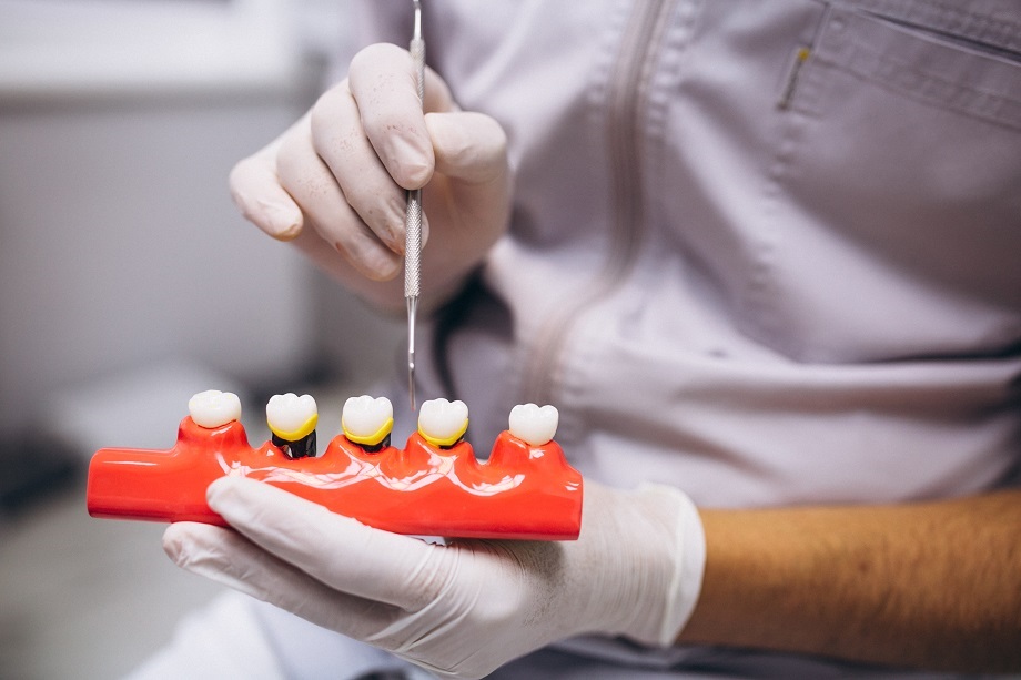 cosmeticperiodontalsurgery